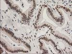 LOX Antibody in Immunohistochemistry (Paraffin) (IHC (P))