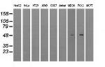 LOX Antibody in Western Blot (WB)