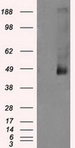 LOX Antibody in Western Blot (WB)