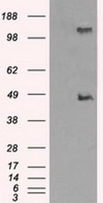 LOX Antibody in Western Blot (WB)