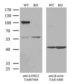 LOXL2 Antibody