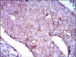 LPA Antibody in Immunohistochemistry (Paraffin) (IHC (P))