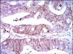 LPA Antibody in Immunohistochemistry (Paraffin) (IHC (P))
