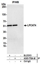 LPCAT4 Polyclonal Antibody