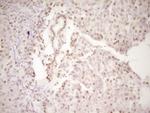 LPIN1 Antibody in Immunohistochemistry (Paraffin) (IHC (P))