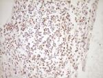 LPIN1 Antibody in Immunohistochemistry (Paraffin) (IHC (P))