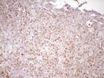 LPIN1 Antibody in Immunohistochemistry (Paraffin) (IHC (P))