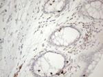 LPIN1 Antibody in Immunohistochemistry (Paraffin) (IHC (P))