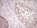 LPIN1 Antibody in Immunohistochemistry (Paraffin) (IHC (P))