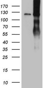 LPIN1 Antibody in Western Blot (WB)