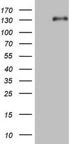 LPIN1 Antibody in Western Blot (WB)