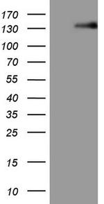 LPIN1 Antibody in Western Blot (WB)