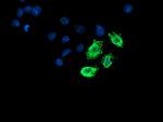 LPL Antibody in Immunocytochemistry (ICC/IF)