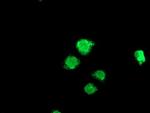 LPL Antibody in Immunocytochemistry (ICC/IF)