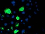 LPL Antibody in Immunocytochemistry (ICC/IF)