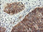 LPL Antibody in Immunohistochemistry (Paraffin) (IHC (P))
