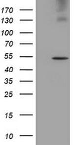 LPL Antibody in Western Blot (WB)