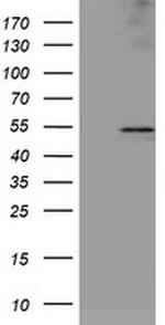 LPL Antibody in Western Blot (WB)