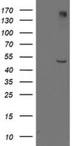 LPL Antibody in Western Blot (WB)