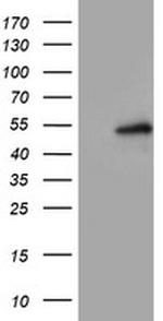 LPL Antibody in Western Blot (WB)