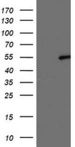 LPL Antibody in Western Blot (WB)