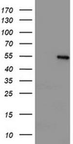 LPL Antibody in Western Blot (WB)