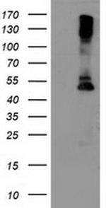LPL Antibody in Western Blot (WB)