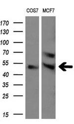 LPL Antibody in Western Blot (WB)