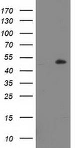 LPL Antibody in Western Blot (WB)
