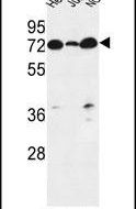 LPPR4 Antibody in Western Blot (WB)