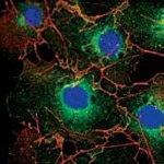 LPP Antibody in Immunocytochemistry (ICC/IF)