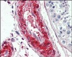 LPP Antibody in Immunohistochemistry (Paraffin) (IHC (P))