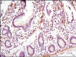 LPP Antibody in Immunohistochemistry (Paraffin) (IHC (P))