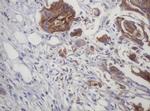 LRCH4 Antibody in Immunohistochemistry (Paraffin) (IHC (P))