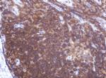 LRCH4 Antibody in Immunohistochemistry (Paraffin) (IHC (P))