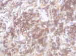 LRCH4 Antibody in Immunohistochemistry (Paraffin) (IHC (P))