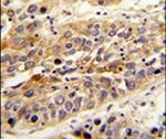 LRG1 Antibody in Immunohistochemistry (IHC)