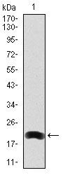 LRP5 Monoclonal Antibody (2B11)