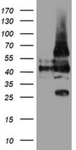 LRRC25 Antibody in Western Blot (WB)