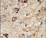 LRRC4 Antibody in Immunohistochemistry (IHC)