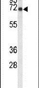 LRRC4 Antibody in Western Blot (WB)