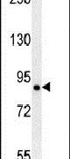 LRRC4B Antibody in Western Blot (WB)