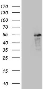 LRRC6 Antibody in Western Blot (WB)