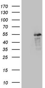 LRRC6 Antibody in Western Blot (WB)
