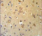 LRRTM1 Antibody in Immunohistochemistry (IHC)