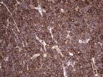 LRRTM1 Antibody in Immunohistochemistry (Paraffin) (IHC (P))