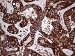 LRRTM1 Antibody in Immunohistochemistry (Paraffin) (IHC (P))
