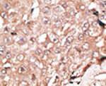 LSD1 Antibody in Immunohistochemistry (IHC)