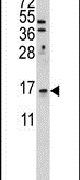LSM1 Antibody in Western Blot (WB)
