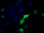 LTA4H Antibody in Immunocytochemistry (ICC/IF)